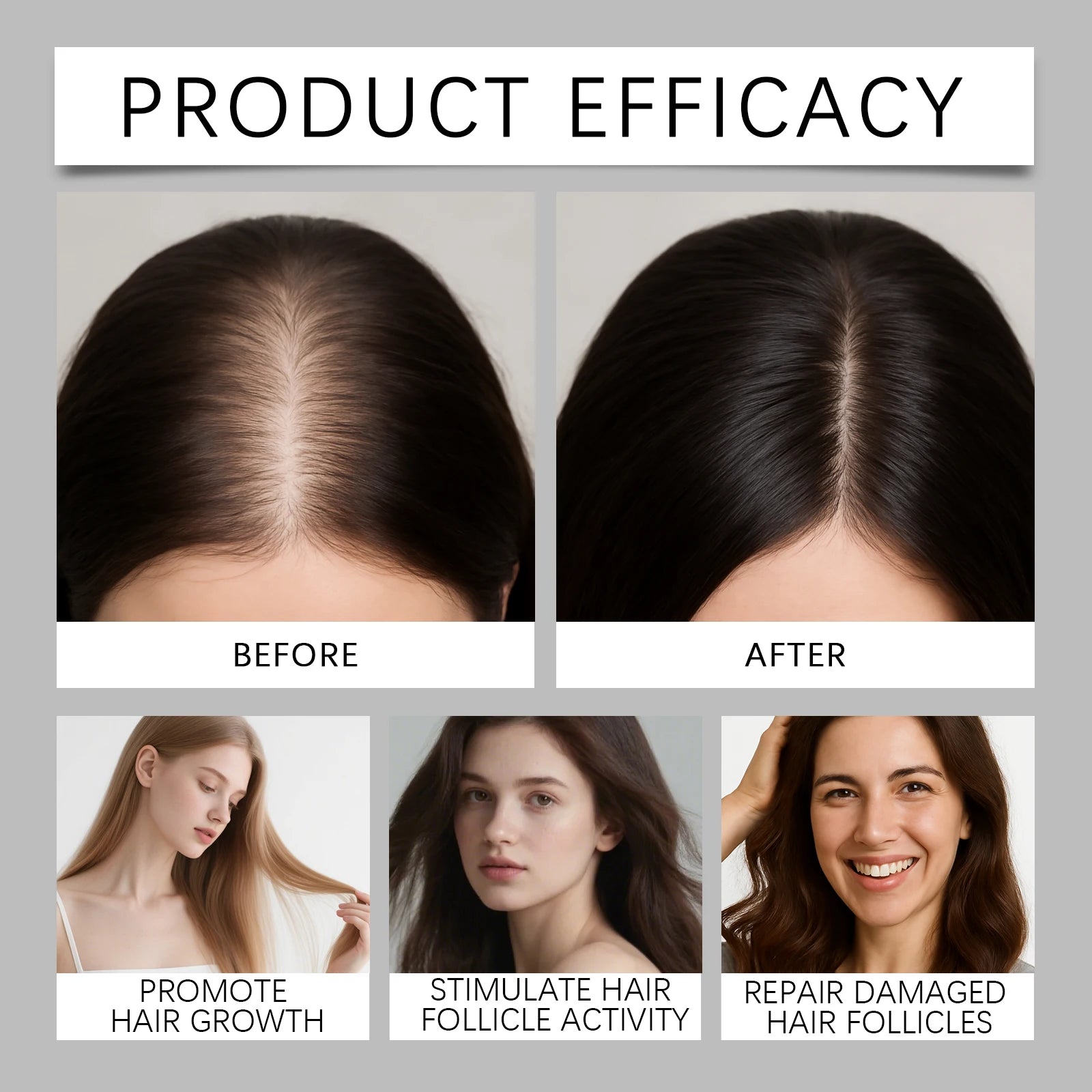 Rosemary Shampoo Bar for Hair Growth Natural Solid Shampoo with Rosemary Oil for Oily Scalp & Dry Hair Care for Women & Men 100g